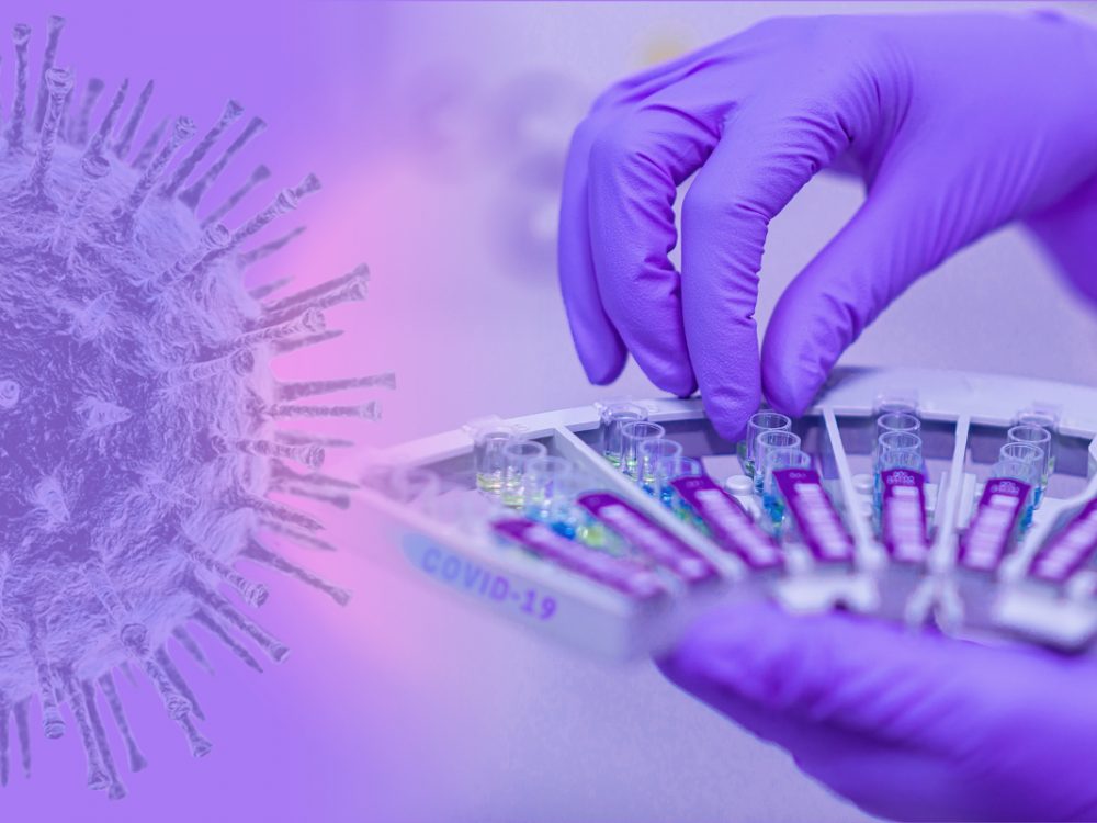 The corona pandemic prompts the Federal Ministry of Economics to amend the Foreign Trade Ordinance with regard to the health sector.